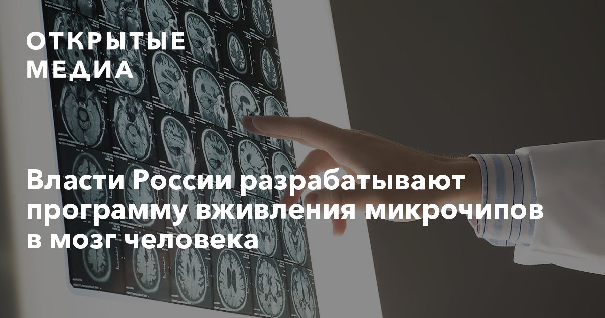 Власти России разрабатывают программу вживления микрочипов в мозг человека